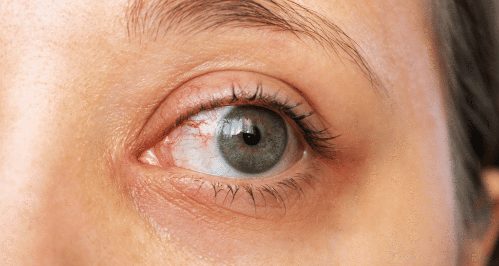 Pros and Cons of Eye Dilation