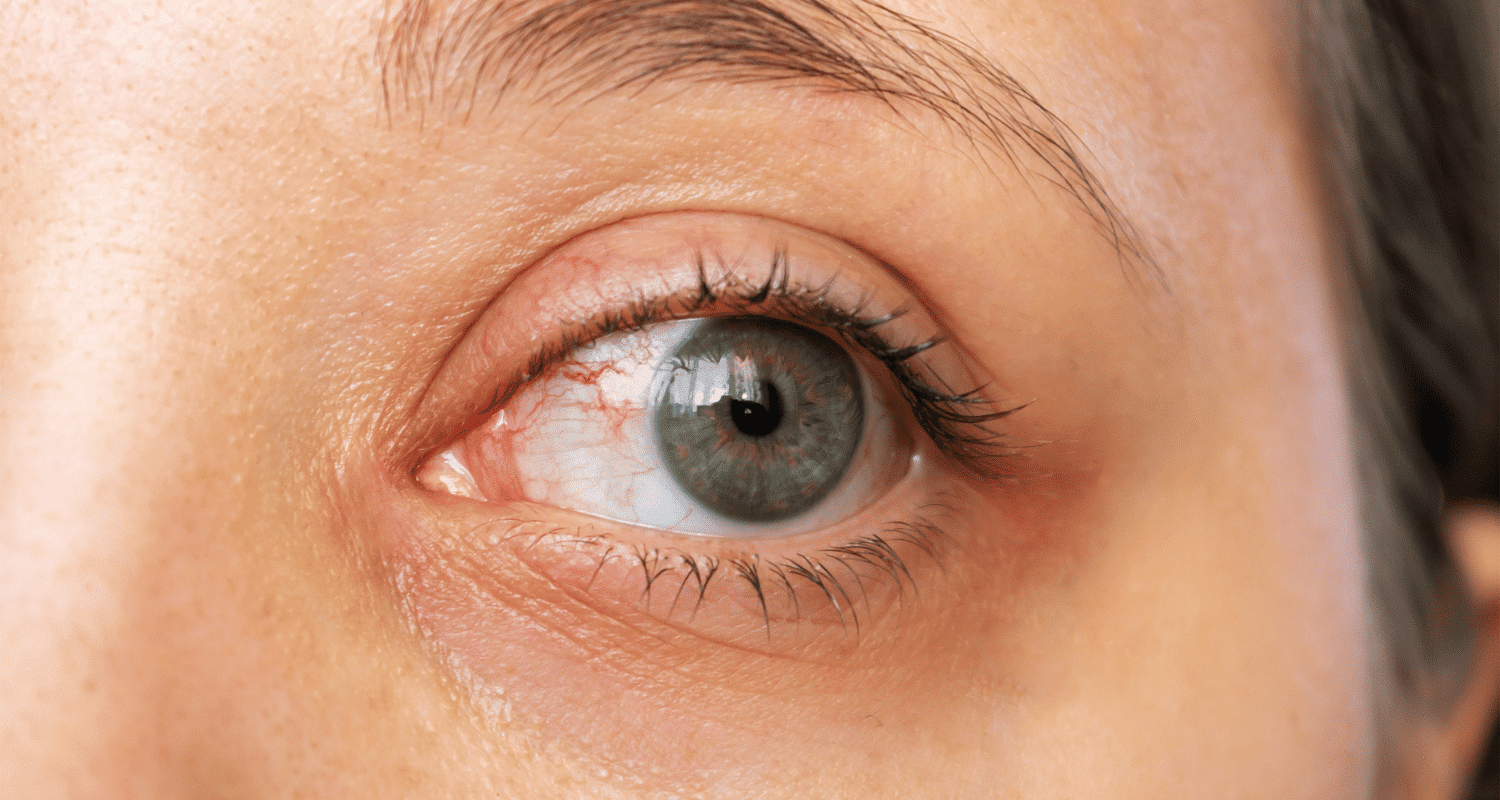 Pros and Cons of Eye Dilation: What You Need to Know - Barnes Talero ...