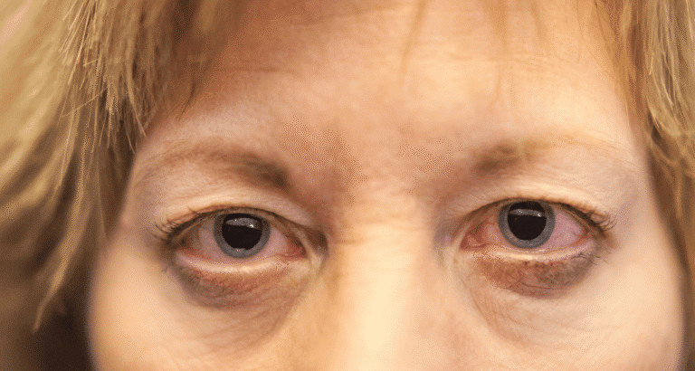 Pros and Cons of Eye Dilation