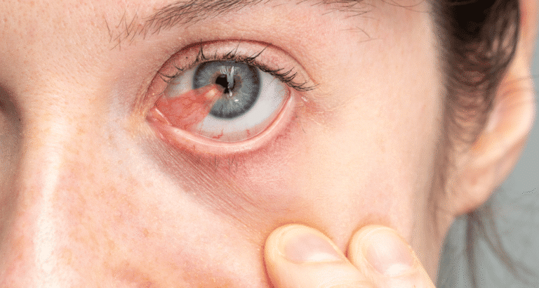 How Do Cataracts Affect Your Vision